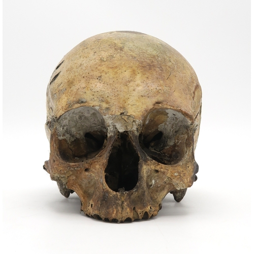 2603 - A HUMAN SKULL The jaw detached, the whole measuring approx. 16cm in height