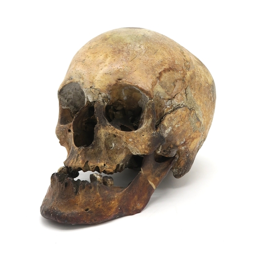 426 - A HUMAN SKULL The jaw detached, the whole measuring approx. 16cm in height