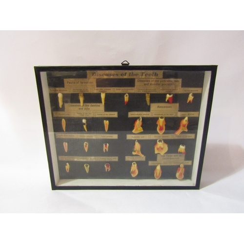 4338 - A vintage anatomical dentistry display, 'Diseases of the Teeth' ebonised case, 25cm x 31cm