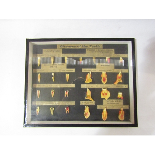 4338 - A vintage anatomical dentistry display, 'Diseases of the Teeth' ebonised case, 25cm x 31cm