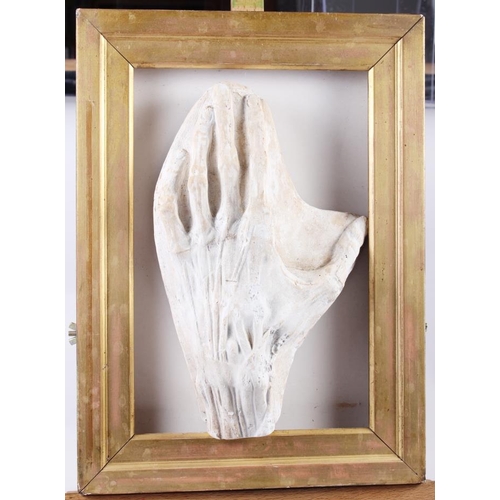 242 - A plaster model of a flayed hand in pine frame, and another similar, on square block base