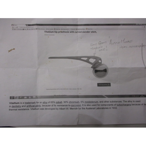 169 - A sample vitallium hip prosthesis, in pre-owned displayed condition