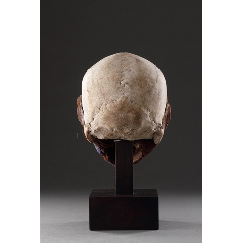 631 - Y A SUPERB MALAKULA ELONGATED HEAD NEW HEBRIDES, VANUATU. CIRCA 1900 Tree fern, bone, pigment, polyc... 