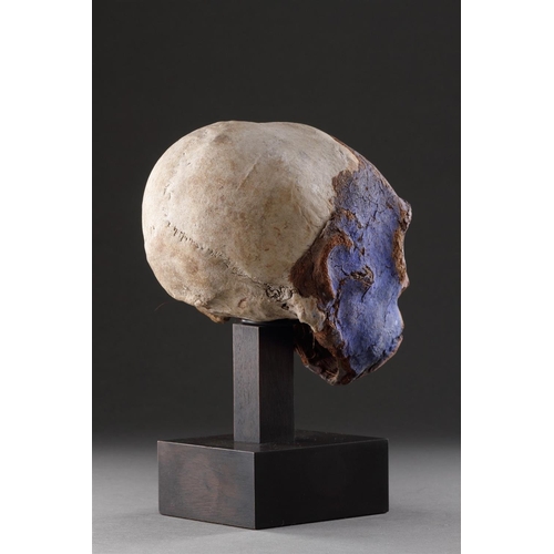 631 - Y A SUPERB MALAKULA ELONGATED HEAD NEW HEBRIDES, VANUATU. CIRCA 1900 Tree fern, bone, pigment, polyc... 