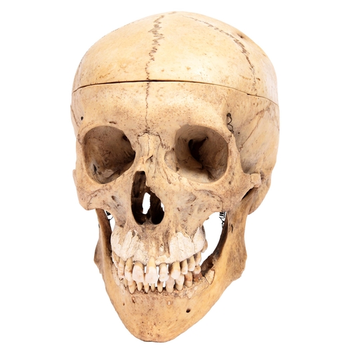 739 - Anatomy. Human skull, with spring-jaw, late 19th/early 20th c