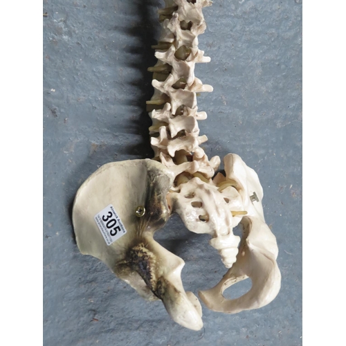 305 - Vertebrae body part - articulated