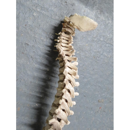 305 - Vertebrae body part - articulated