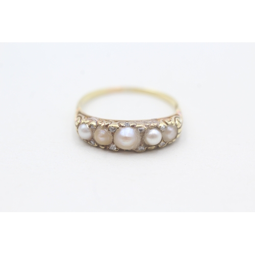 189 - 18ct gold antique pearl & diamond dress ring (3g) Size P