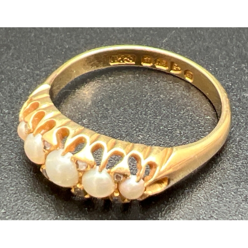 1004 - An antique Edwardian 18ct gold, pearl and diamond ring. Set with 5 graduated white pearls and 8 smal... 