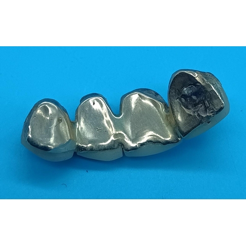 417 - Dental Gold Teeth 4.22 gms total weight