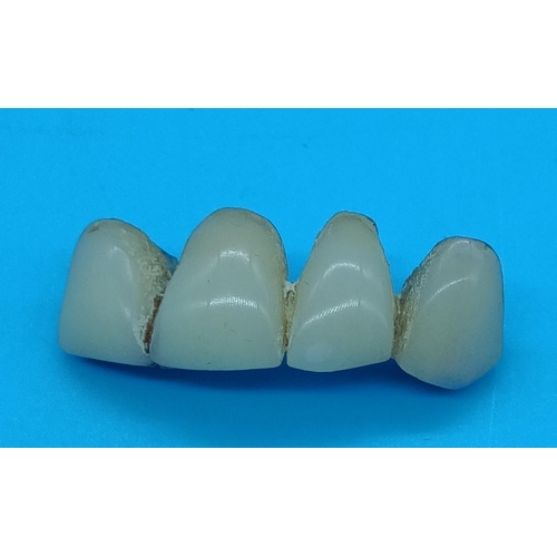 417 - Dental Gold Teeth 4.22 gms total weight