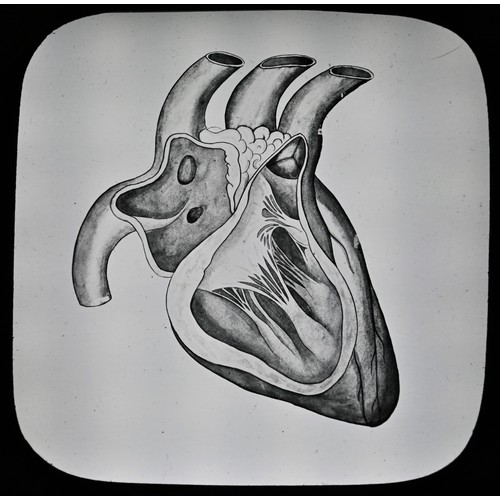 5787B - Magic Lantern Slides - Anatomy, The Human Body, a series of 50 b/w anatomical slides, cased en suite