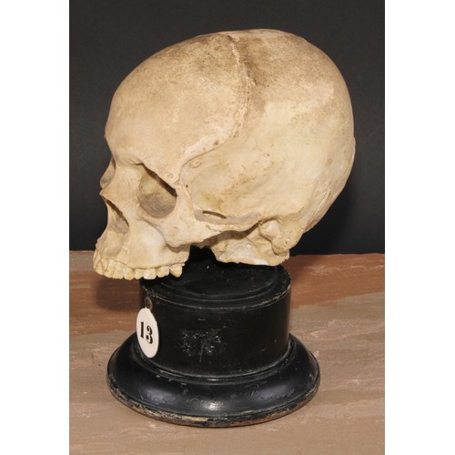 617 - Medical - Anatomy - an early 20th century doctor's plaster anatomical model, of a human skull, mount... 