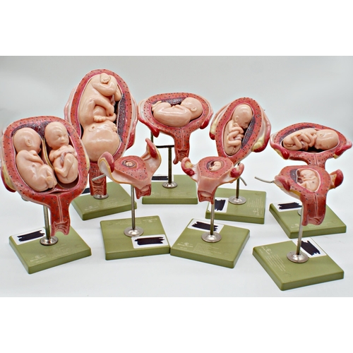 149 - Somso Modelle scientific models of an embryo 'Series Showing Pregnancy' MS11, MS12, MS12/1-8, MS13, ... 