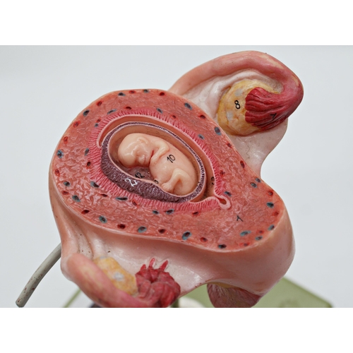 149 - Somso Modelle scientific models of an embryo 'Series Showing Pregnancy' MS11, MS12, MS12/1-8, MS13, ... 