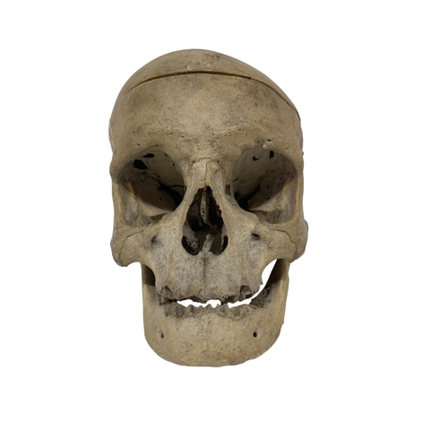 1046 - Early 20th century human medical skull with hinged jaw and clasps, H 20cm x W 13cm