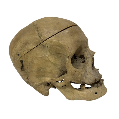 1046 - Early 20th century human medical skull with hinged jaw and clasps, H 20cm x W 13cm