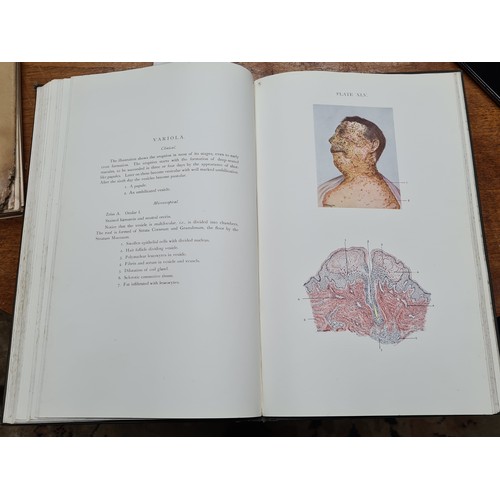 829 - An antique large hardback book titled 'An Atlas of Dermatology - Shewing the Appearances Clinical an... 