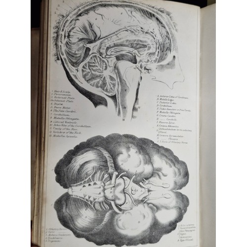 243 - A Practical Treasure on Medical Jurisprudence, with so much of Anatomy, Physiology, Pathology, and t... 