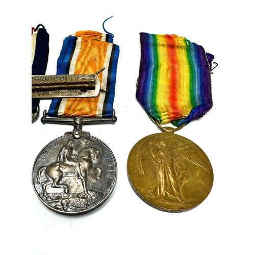 375 - WW.1 Military Medal - M.M & Pair & Wound Stripe. Named. G. 21416 Pte. A.C.J. Lee the queens .r