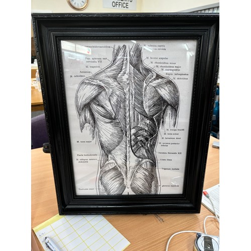 54 - Framed Human muscle pattern print on canvas, measures approximately 19 inches by 15 inches