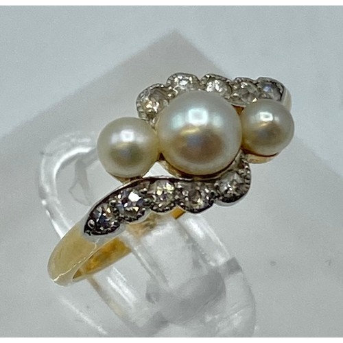 171 - An unmarked yellow and white metal pearl and diamond ring. Three graduating button pearls with flute... 