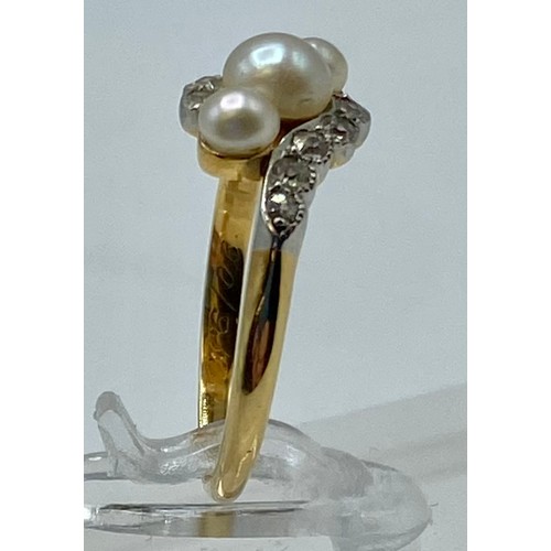 171 - An unmarked yellow and white metal pearl and diamond ring. Three graduating button pearls with flute... 