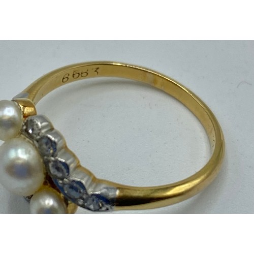 171 - An unmarked yellow and white metal pearl and diamond ring. Three graduating button pearls with flute... 