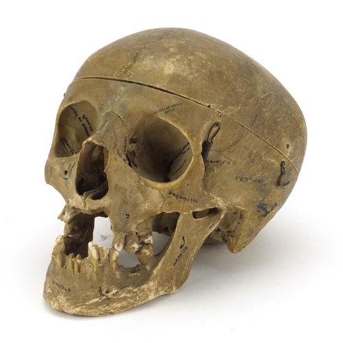95 - 19th century Anatomical human skull, 14cm high x 19cm in length