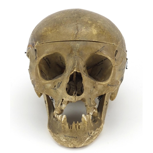 95 - 19th century Anatomical human skull, 14cm high x 19cm in length