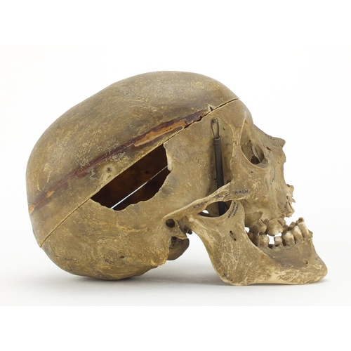 95 - 19th century Anatomical human skull, 14cm high x 19cm in length