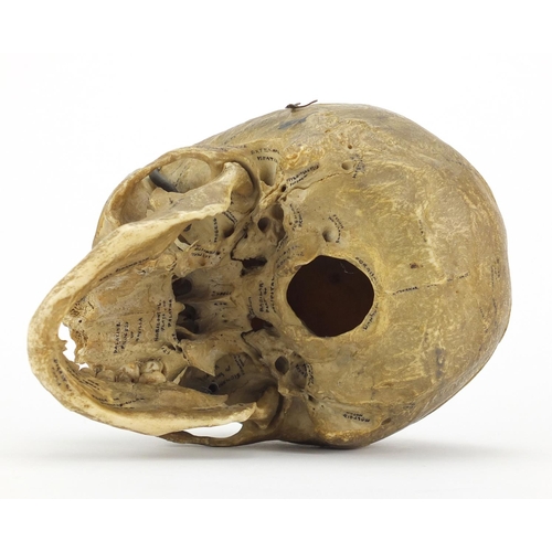 95 - 19th century Anatomical human skull, 14cm high x 19cm in length