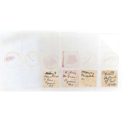 359 - Collection of early 20th century scientific interest microscope prepared glass slides housed in a fi... 