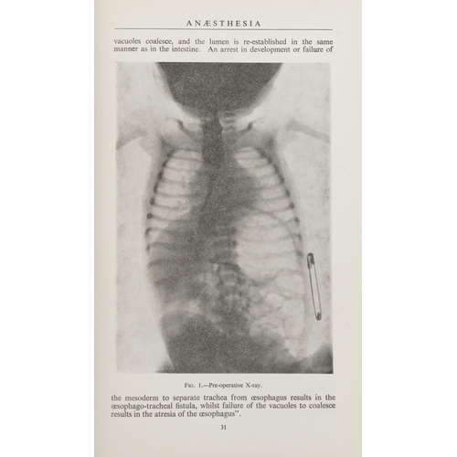 1364 - Three volumes on Anaesthesia with black and white illustrations