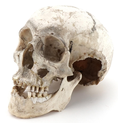 1163A - Millikin & Lawley, medical human skull with paper label - 67 & 68 Chandos St Strand W.C