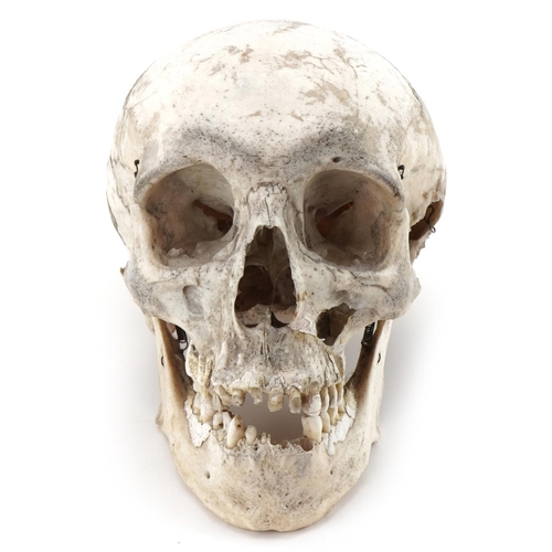 1163A - Millikin & Lawley, medical human skull with paper label - 67 & 68 Chandos St Strand W.C