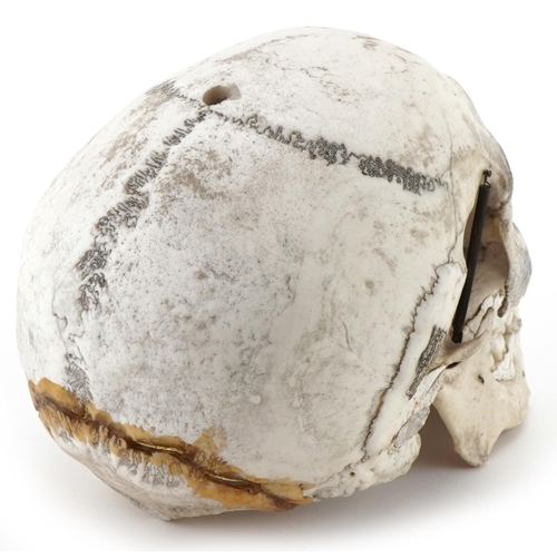 1163A - Millikin & Lawley, medical human skull with paper label - 67 & 68 Chandos St Strand W.C