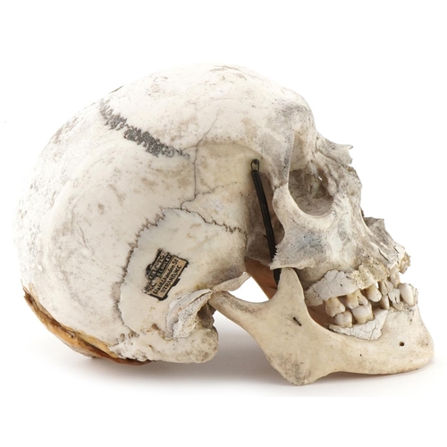 1163A - Millikin & Lawley, medical human skull with paper label - 67 & 68 Chandos St Strand W.C