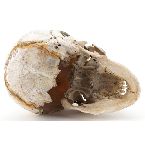 1163A - Millikin & Lawley, medical human skull with paper label - 67 & 68 Chandos St Strand W.C