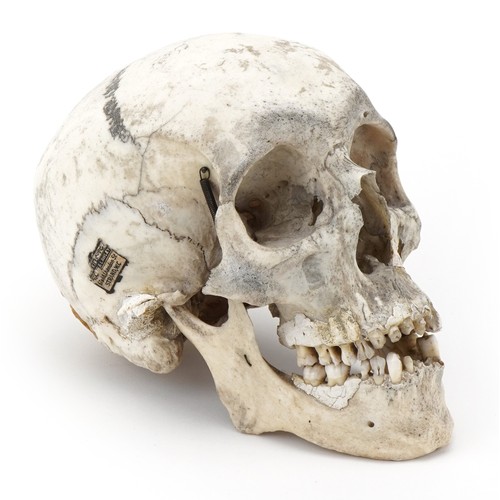 1163A - Millikin & Lawley, medical human skull with paper label - 67 & 68 Chandos St Strand W.C