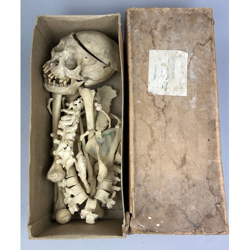 56 - A VICTORIAN HUMAN HALF SKELETON IN A BOX, comprising a full skull, upper body bones, ribcage and pel... 