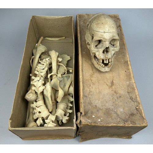 56 - A VICTORIAN HUMAN HALF SKELETON IN A BOX, comprising a full skull, upper body bones, ribcage and pel... 