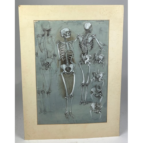 120 - A SCIENTIFIC INTEREST INK DRAWING AND ACRYLIC PAINTING ON PAPER OF HUMAN SKELETONS, 

Signed 'Lillii... 