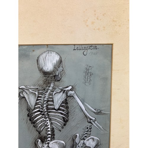 120 - A SCIENTIFIC INTEREST INK DRAWING AND ACRYLIC PAINTING ON PAPER OF HUMAN SKELETONS, 

Signed 'Lillii... 