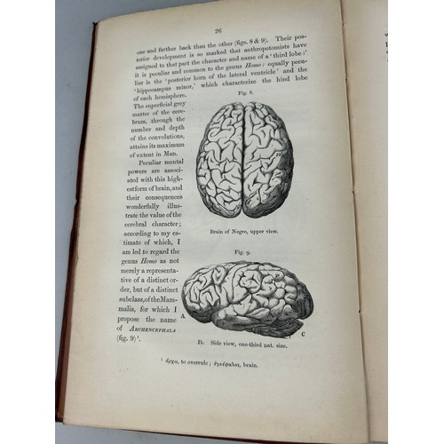 157 - RICHARD OWEN ON THE CLASSIFICATION AND GEOGRAPHICAL DISTRIBUTION OF THE MAMMALIA


Being the lecture... 