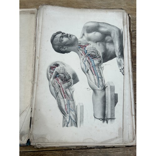 398 - JOSEPH MACLISE: 'FROM SURGICAL ANATOMY' 1851: A QUANTITY OF LOOSE, LARGE HAND COLOURED STEEL ENGRAVI... 