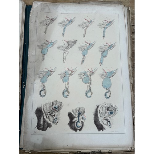 398 - JOSEPH MACLISE: 'FROM SURGICAL ANATOMY' 1851: A QUANTITY OF LOOSE, LARGE HAND COLOURED STEEL ENGRAVI... 