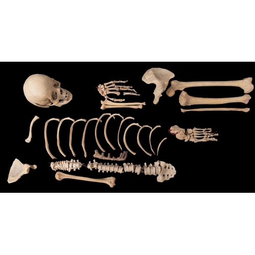 39 - A mid 20th century medical human half skeleton, comprising skull with lower jaw, spine, sternum, sca... 