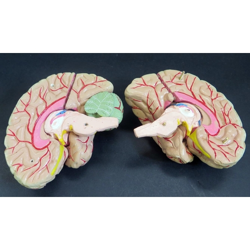 427 - Vintage Composite Teaching Model of the Human Brain.  Comes apart to reveal inner workings.