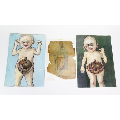 1307 - Dulcie Pillers. Two anatomical watercolours of children's abdomens, signed and dated 1951 36 x 25cm ... 